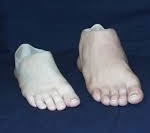 foot prosthesis cost,toe prosthesis india, silicone foot prosthetics,toe prosthetics, foot and toe prosthesis, foot and leg prosthesis, drop foot prosthesis