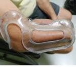 limb prosthesis,limb prosthesis cost,limb prosthesis india,silicone limb prosthesis,limb prosthetics,limb prosthetics india