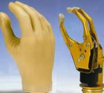  myoelectric arm prosthesis cost, myoelectric hand prosthesis cost, myoelectric prosthetics, myoelectric prosthesis companies,myoelectric foot prosthesis