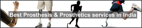 prosthesis,prosthetics,prosthesis services india,prosthetics services india,limb prosthesis cost,silicone prosthesis